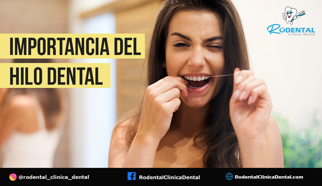 La Importancia Del Hilo Dental Un Paso Clave Para Tu Salud Bucal Rodental Clínica Dental 1076